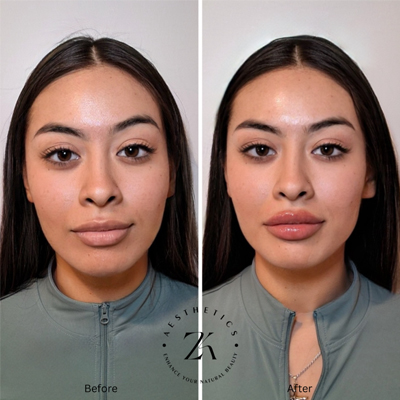 ZK Aesthetics Instagram